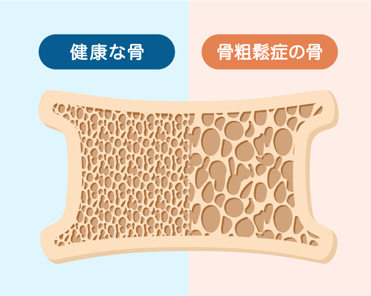 骨粗鬆症治療と骨折治療に詳しい整形外科専門医が担当します